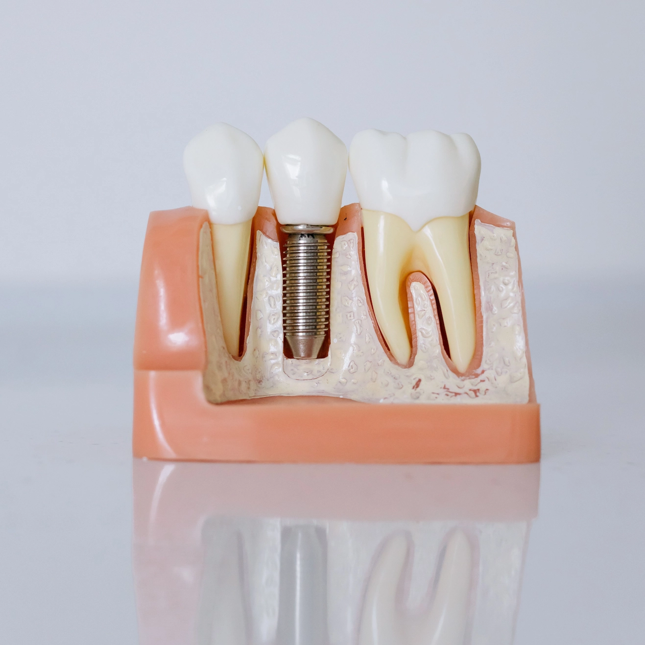 Dott. Erjol Zaka, Direttore Sanitario Zaka Dental